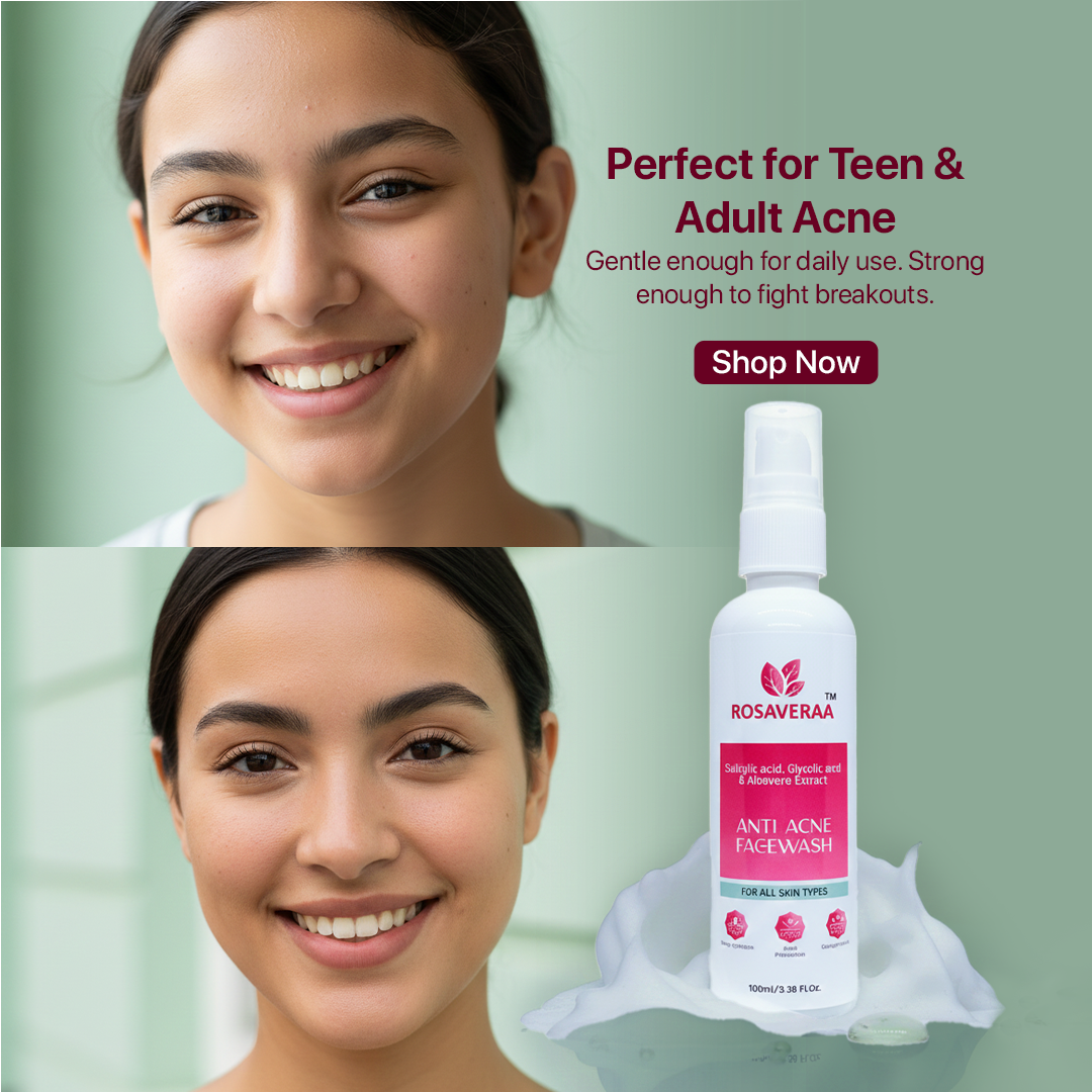Anti Acne Face Wash | 100ml
